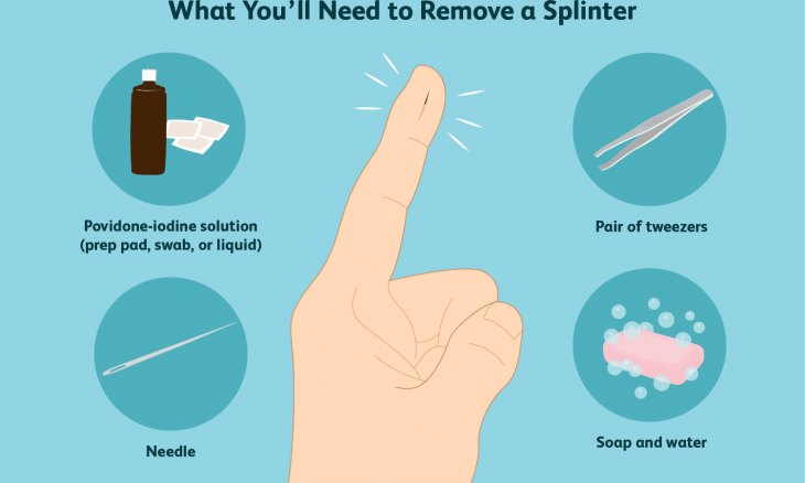  how to remove a splinter