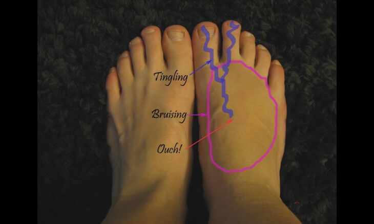 Top of foot pain