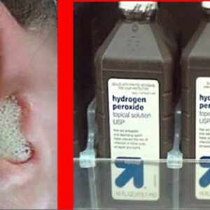 hydrogen peroxide in ear