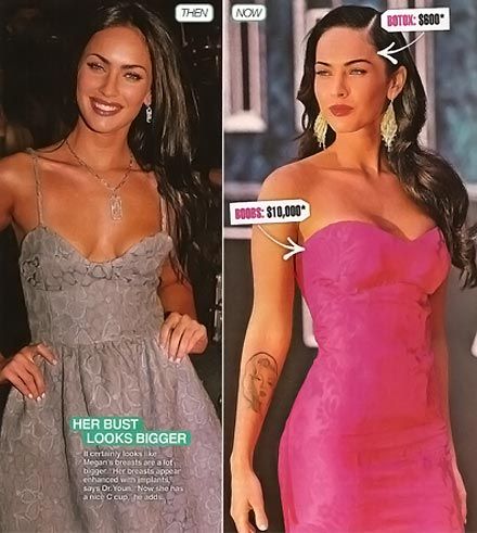 Megan Fox Before and After Plastic Surgery